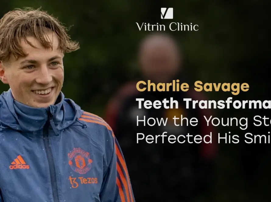 Charlie Savage Teeth Transformation: How the Young Star Perfected His Smile