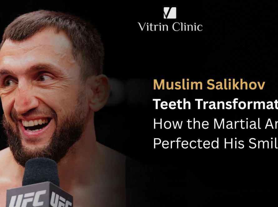 Muslim Salikhov Teeth Transformation