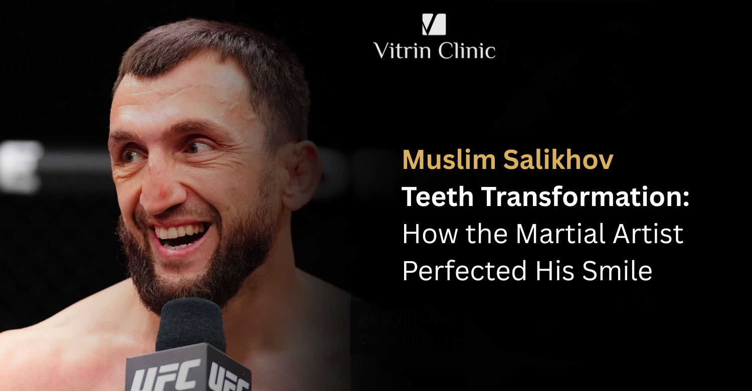 Muslim Salikhov Teeth Transformation