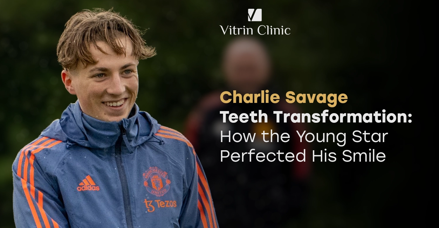 Charlie Savage Teeth Transformation: How the Young Star Perfected His Smile