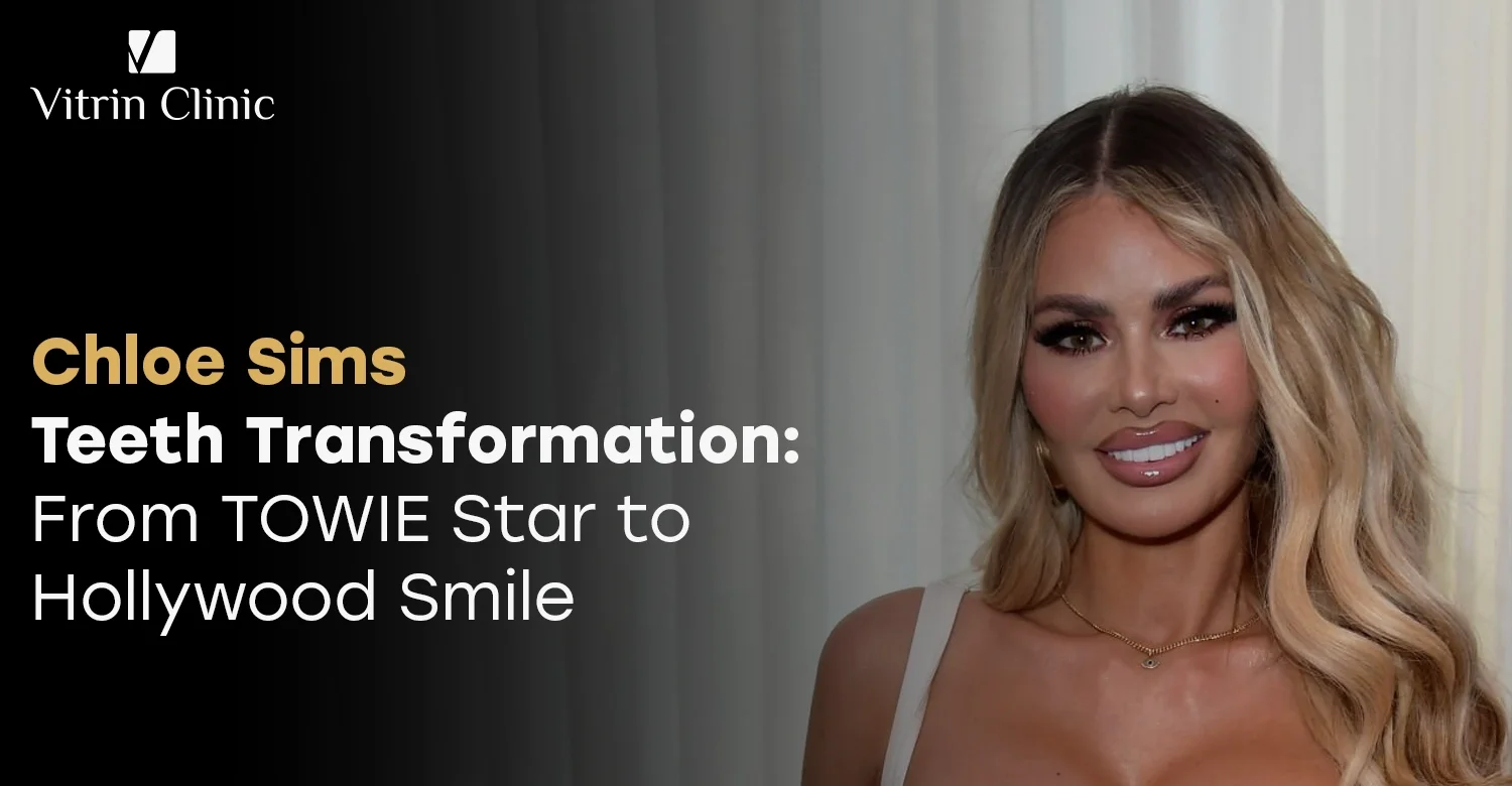 Chloe Sims Teeth Transformation 2026