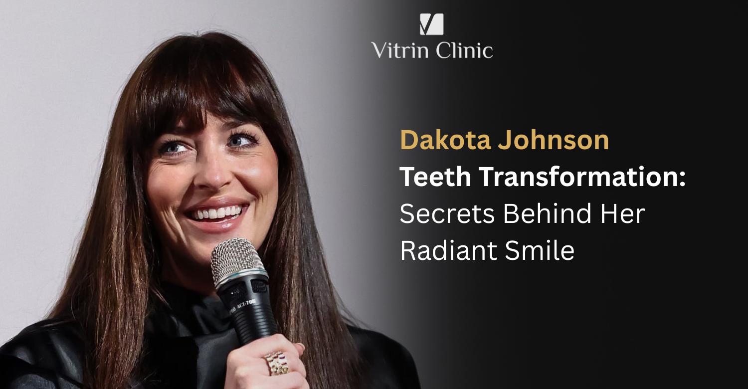 Dakota Johnson Teeth: The Actress's Complete Smile Evolution