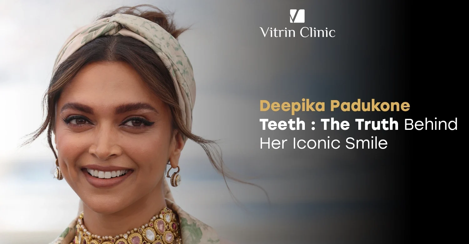 Deepika Padukone Teeth: