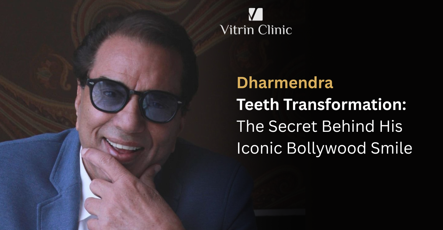 Dharmendra Teeth Transformation