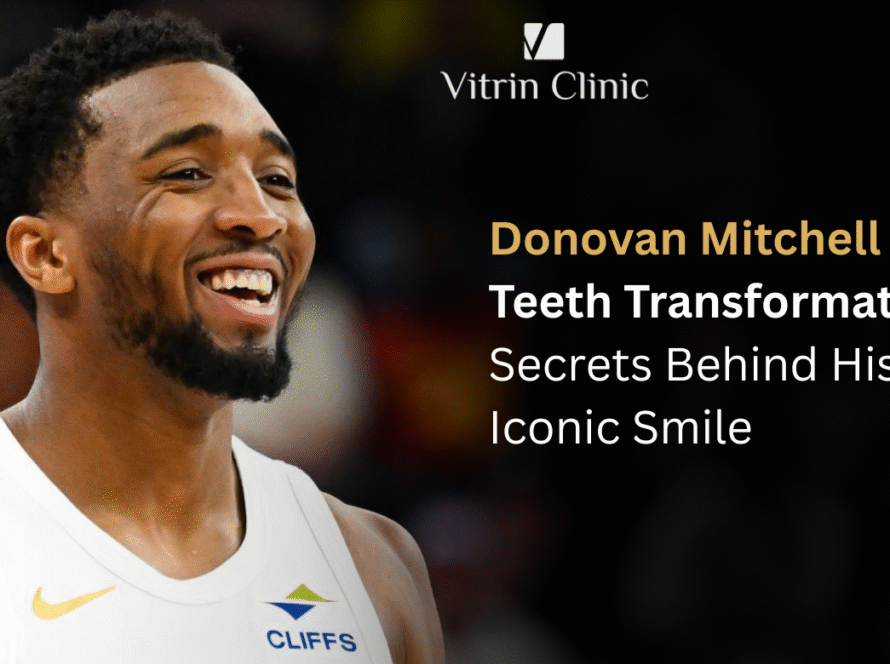 donovan mitchell teeth