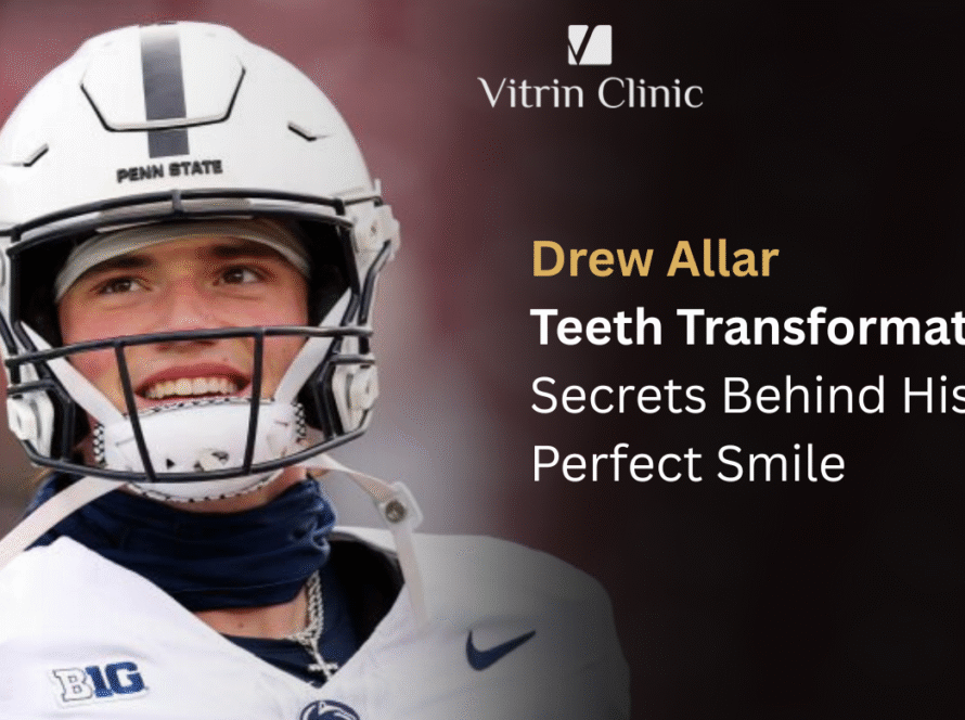 drew allar teeth