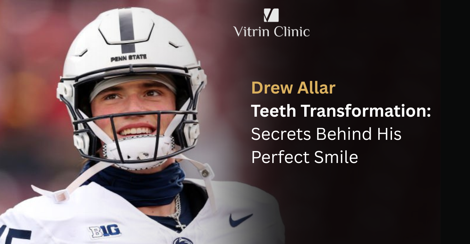 drew allar teeth