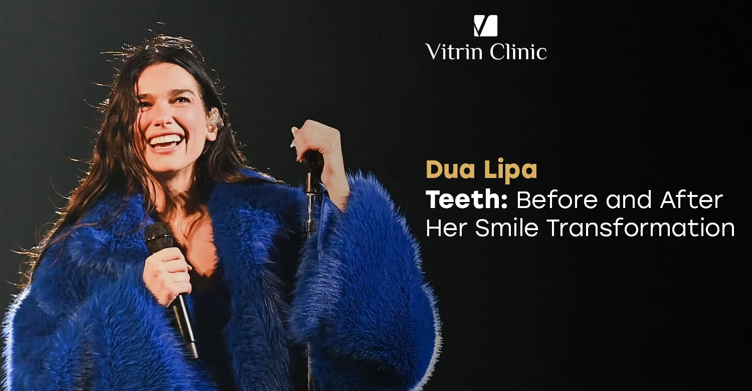 Dua Lipa Teeth