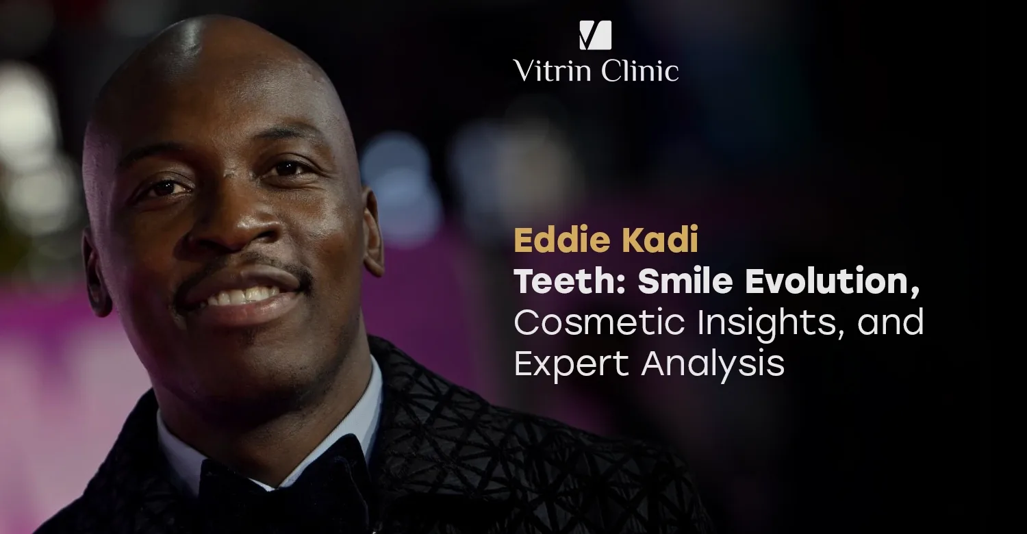 Eddie Kadi Teeth