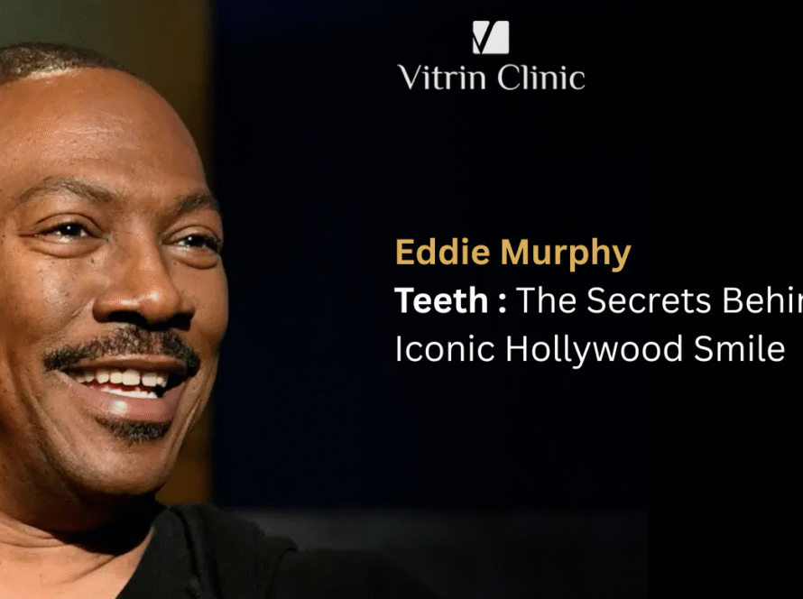 Eddie Murphy Teeth