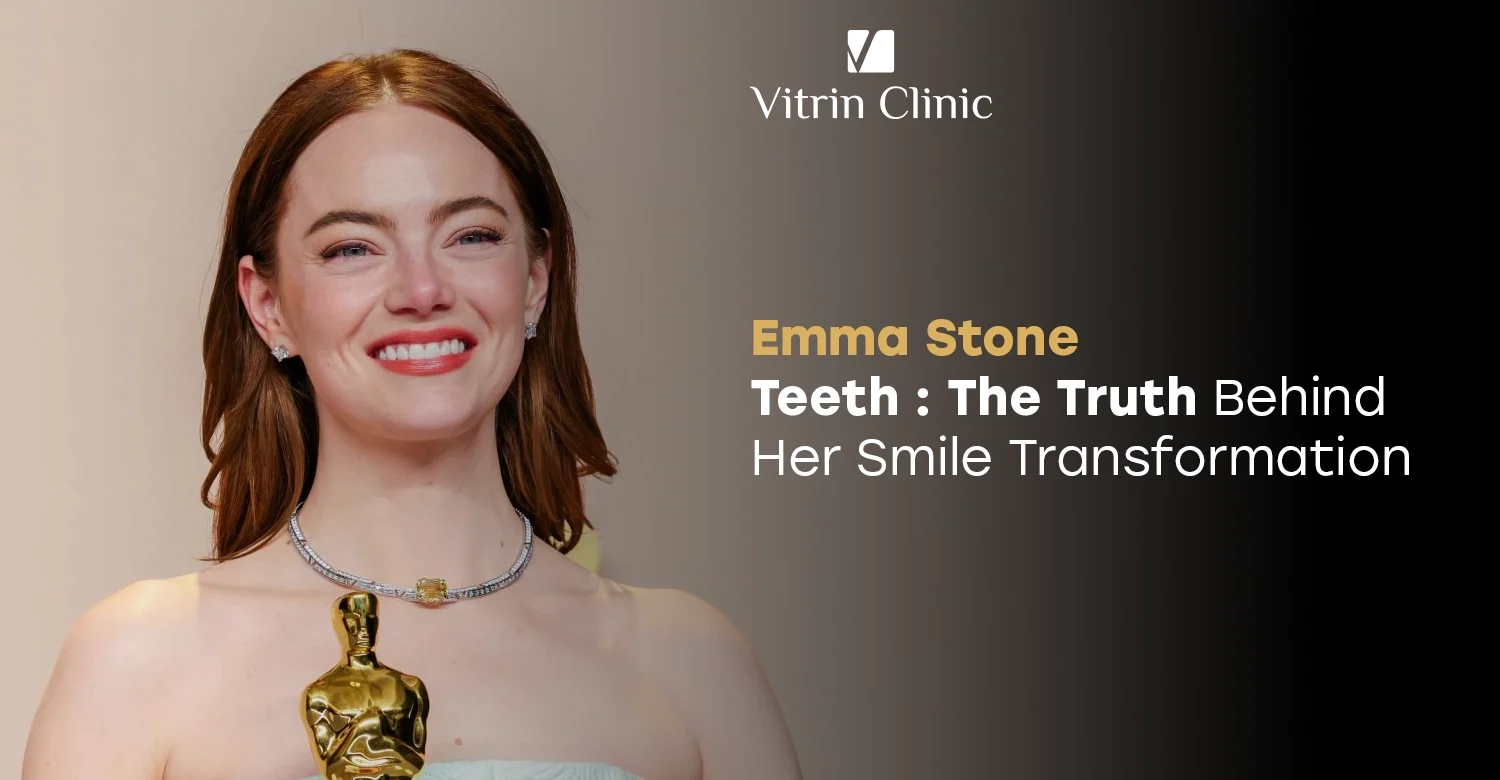Emma Stone Teeth