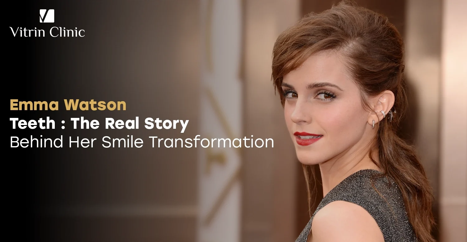 Emma Watson Teeth