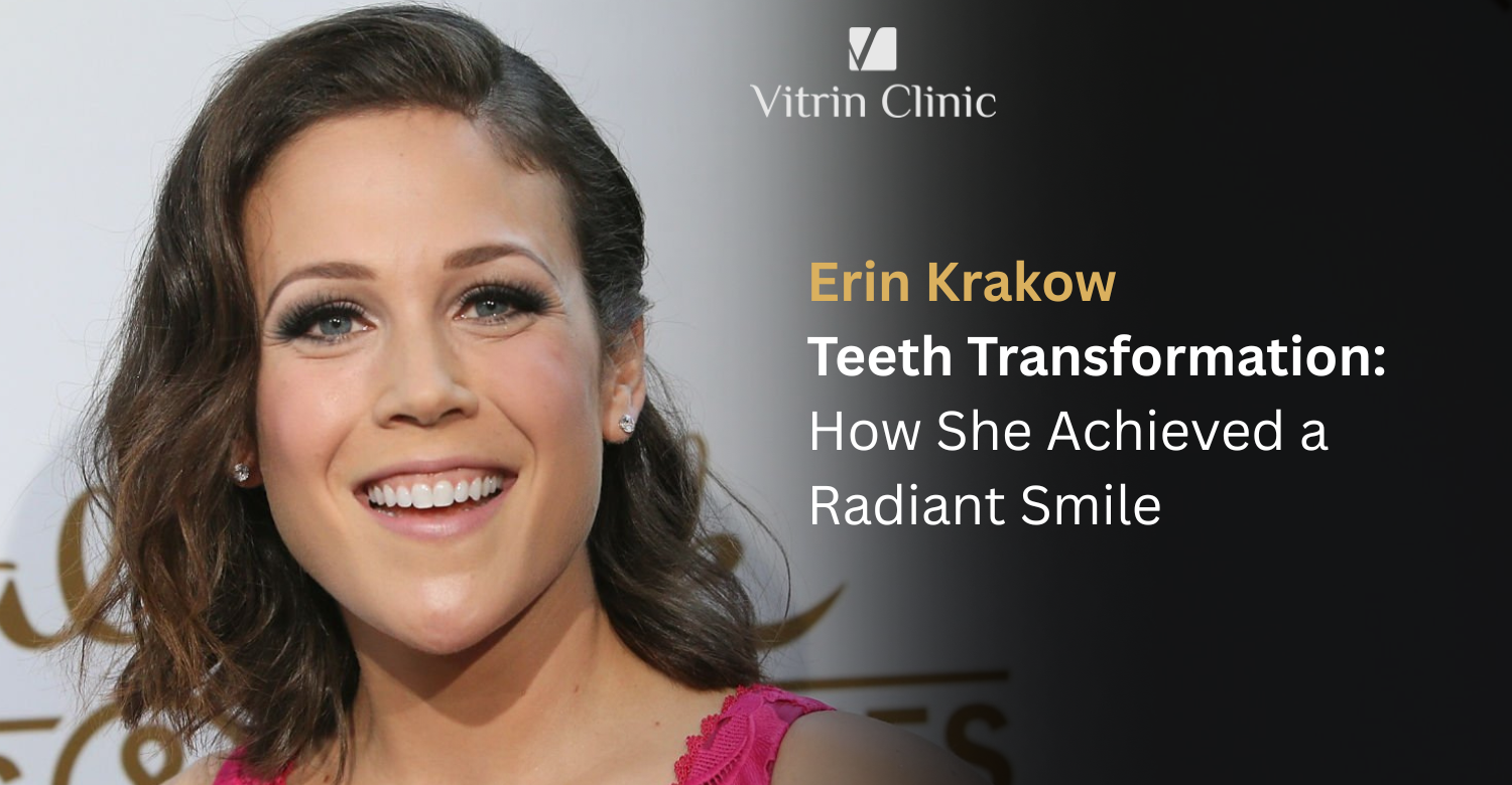 Erin Krakow Teeth: The Actress's Complete Smile Evolution
