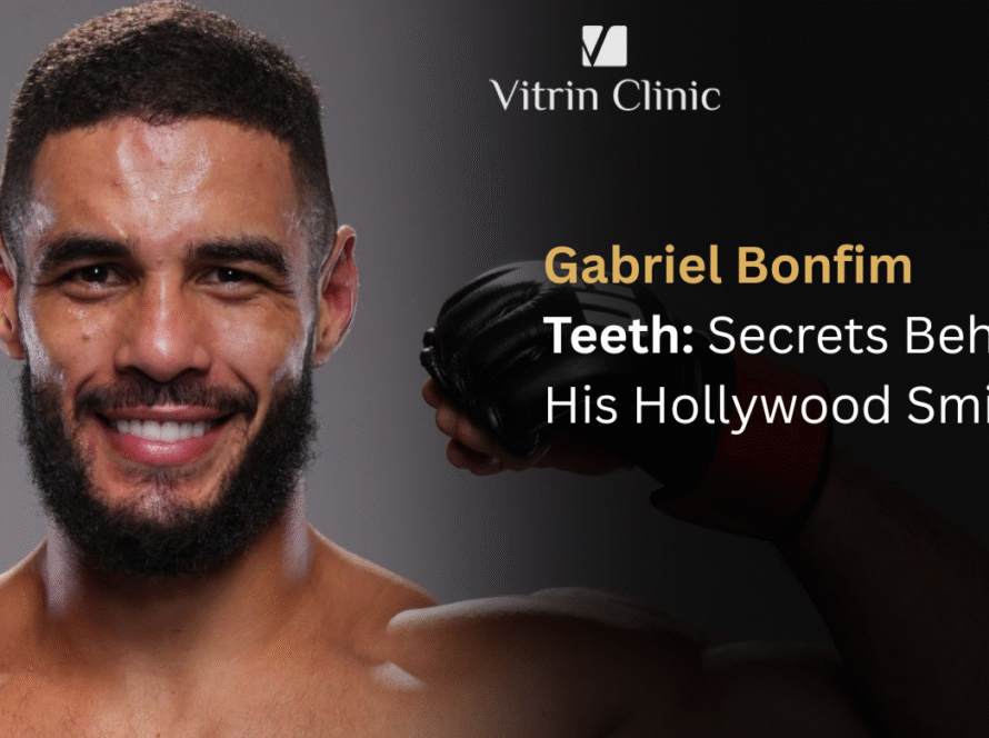 Gabriel Bonfim Teeth