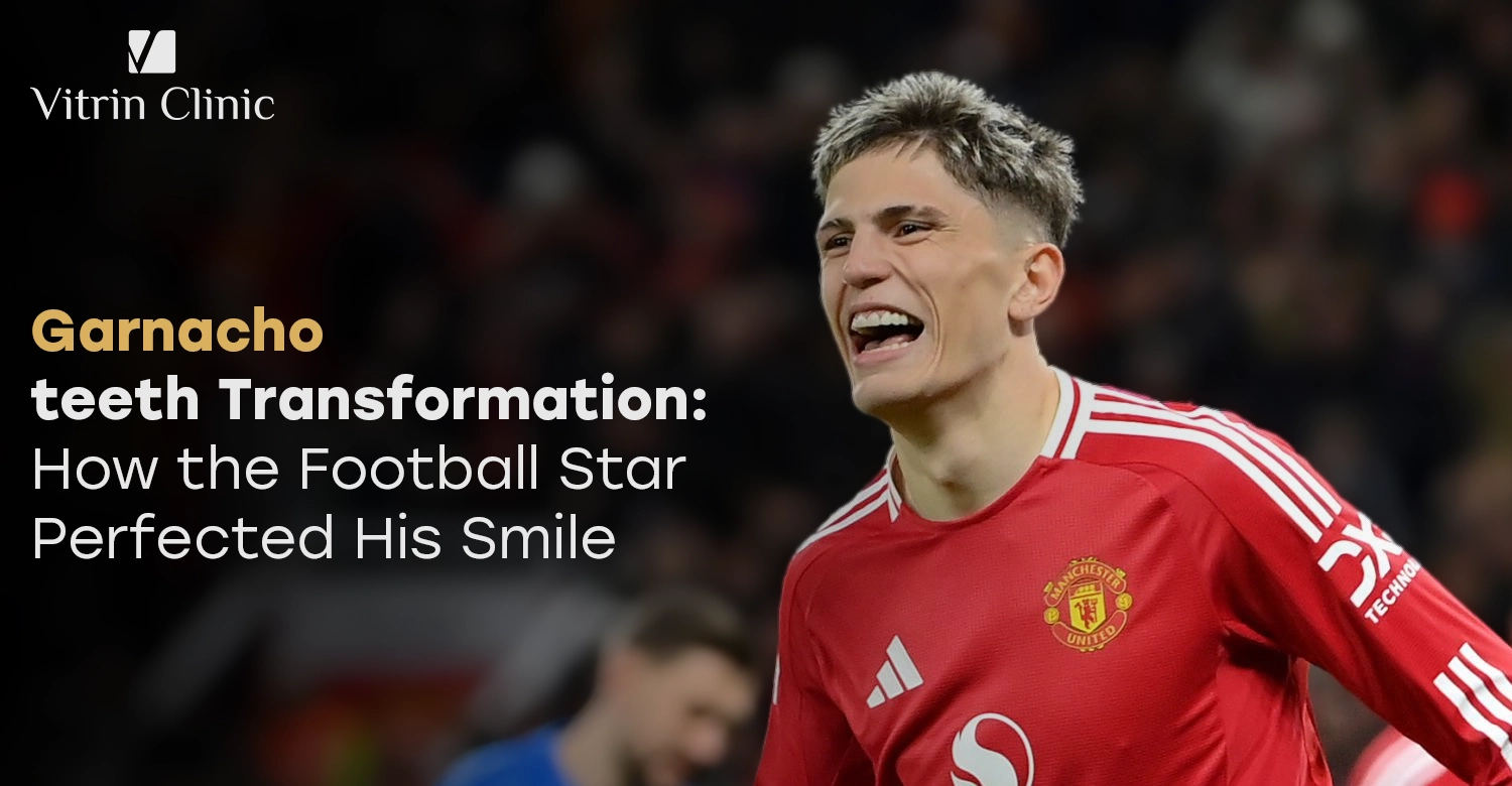 Garnacho teeth