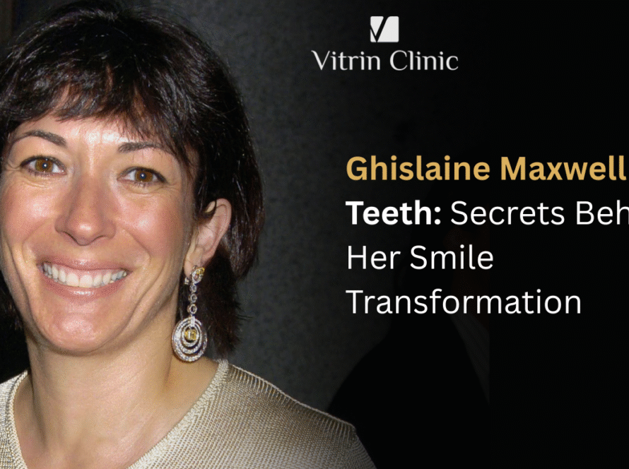 Ghislaine Maxwell Teeth