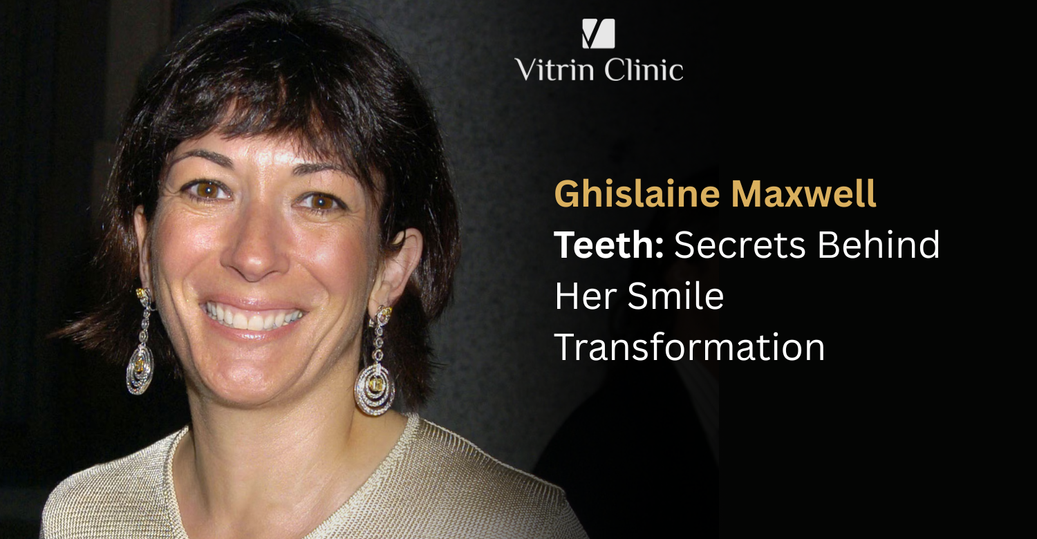 Ghislaine Maxwell Teeth