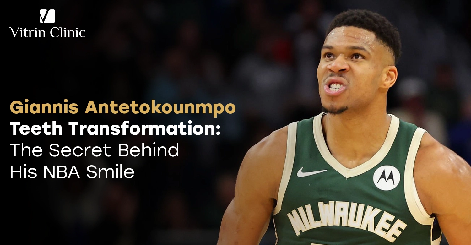 Giannis Antetokounmpo Teeth