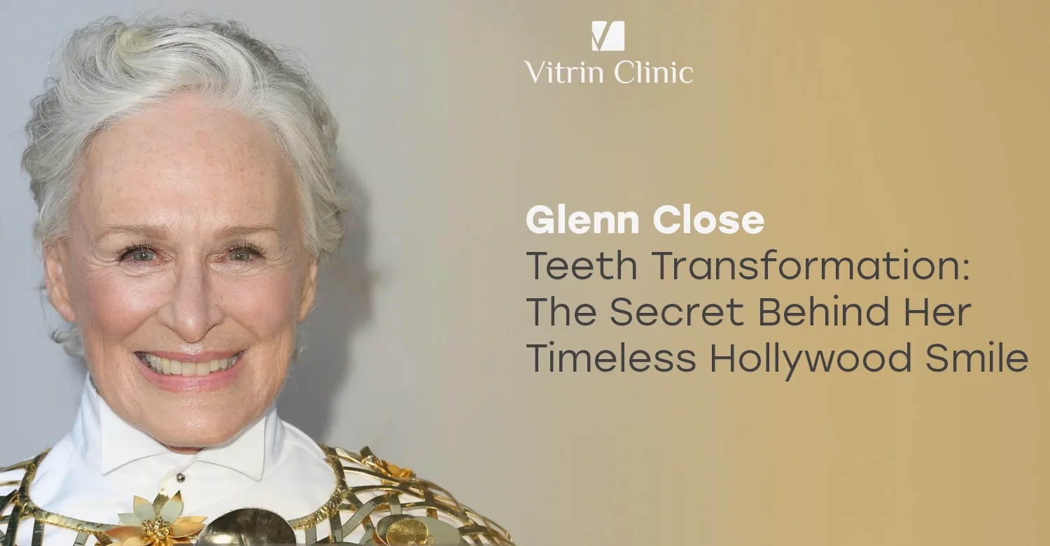 Glenn Close Teeth: The Actress's Timeless Smile Evolution