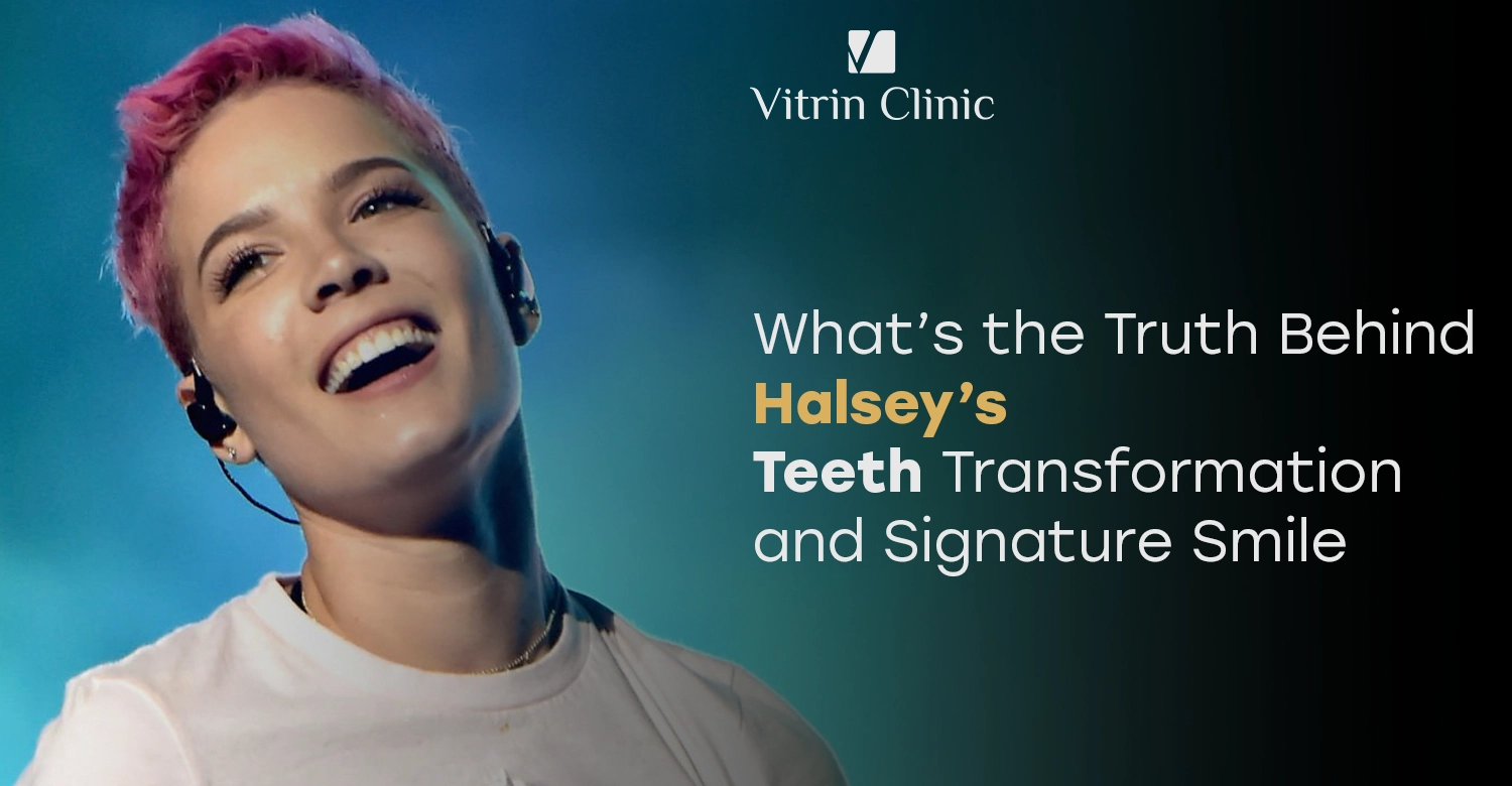 Halsey Teeth