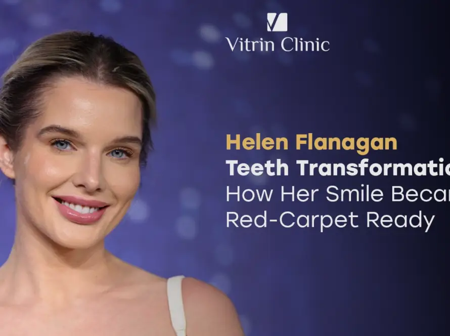 Helen Flanagan Teeth: The Actress's Complete Smile Evolution