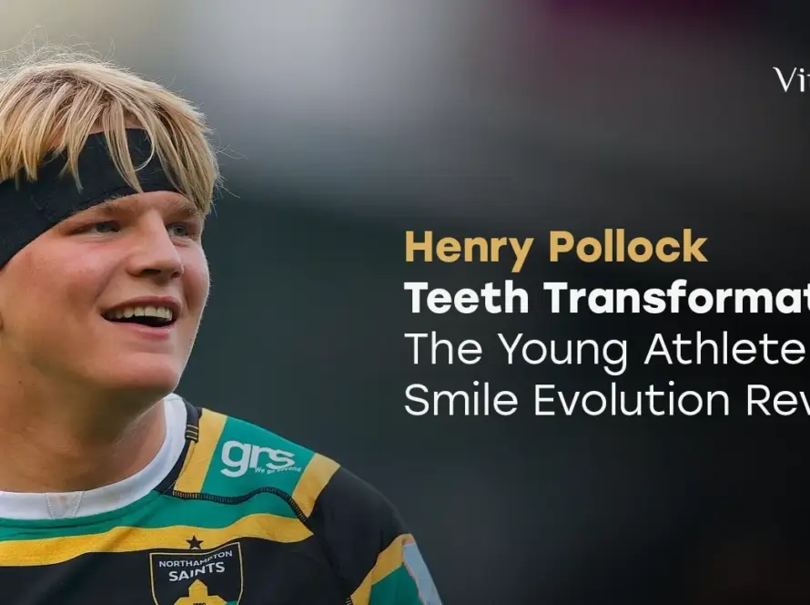 Henry Pollock Teeth Transformation
