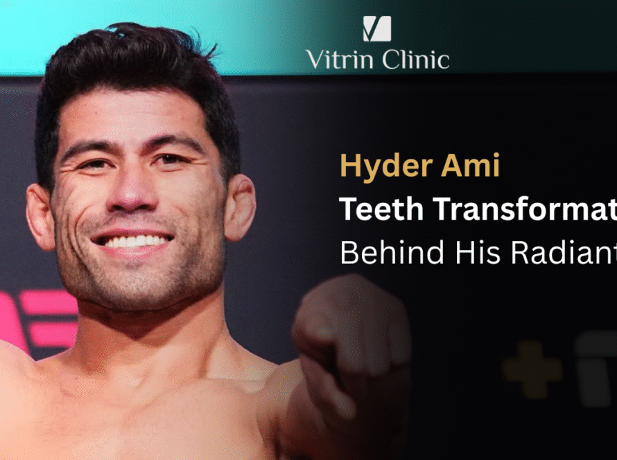 Hyder Amil Teeth Transformation
