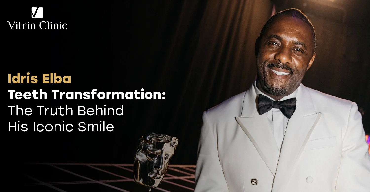 Idris Elba Teeth