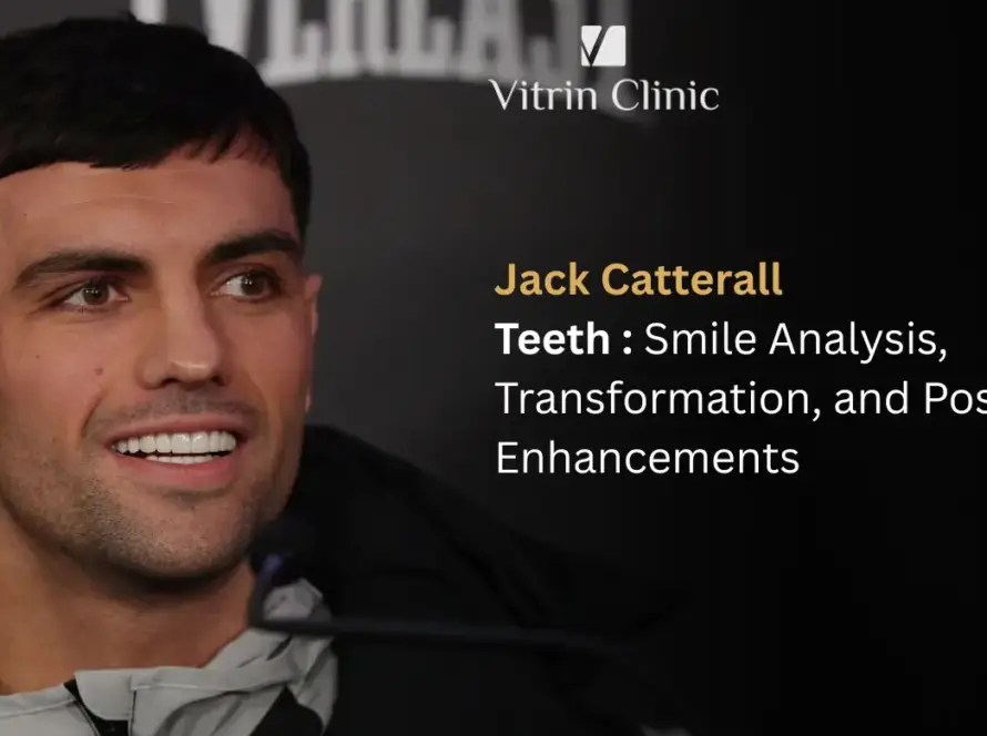 Jack Catterall Teeth: The Boxer's Complete Smile Evolution