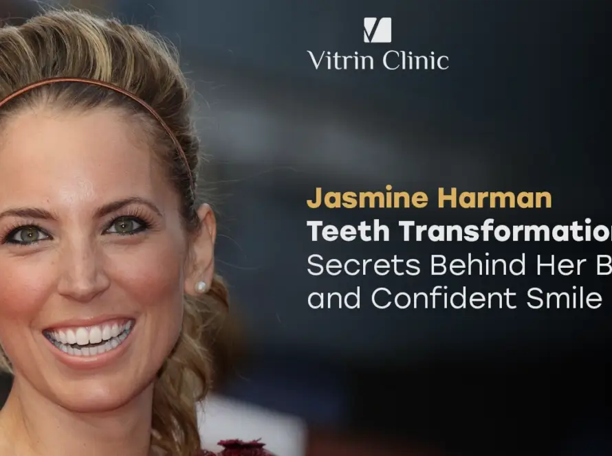 Jasmine Harman teeth