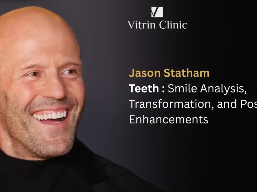 Jason Statham Teeth: The Action Star's Complete Smile Evolution
