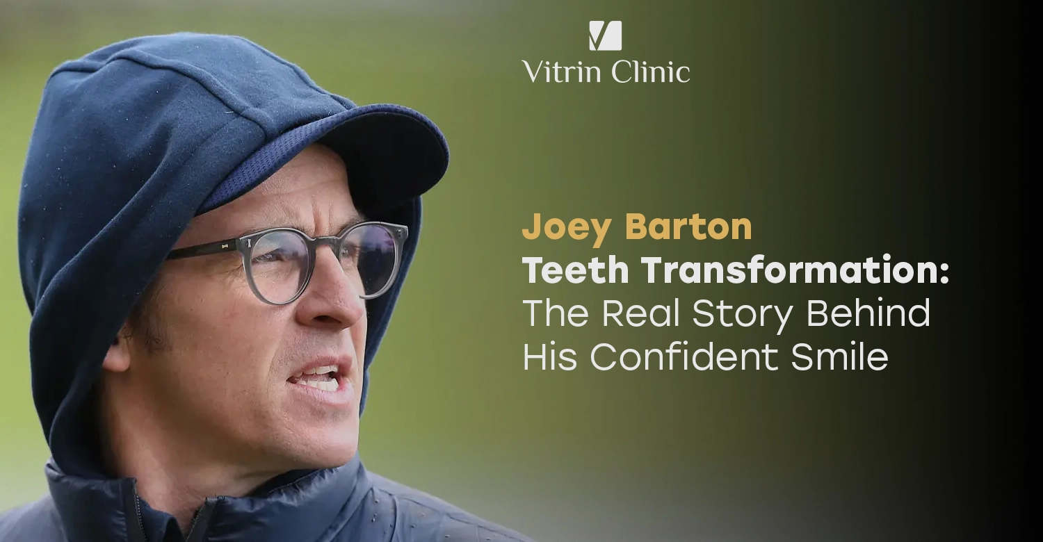 Joey Barton Teeth Transformation: The Real Story Behind His Confident Smile
