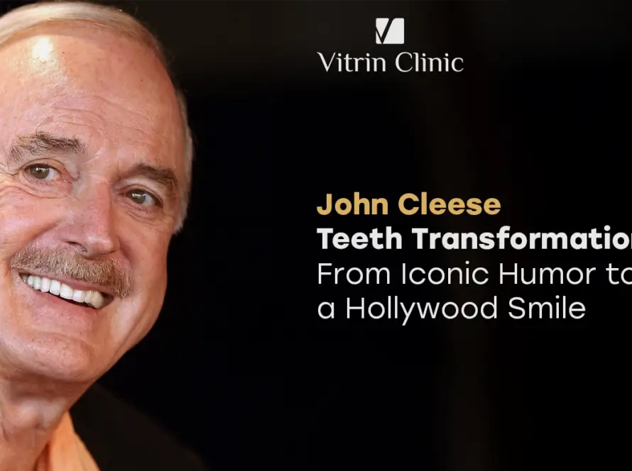 John Cleese teeth