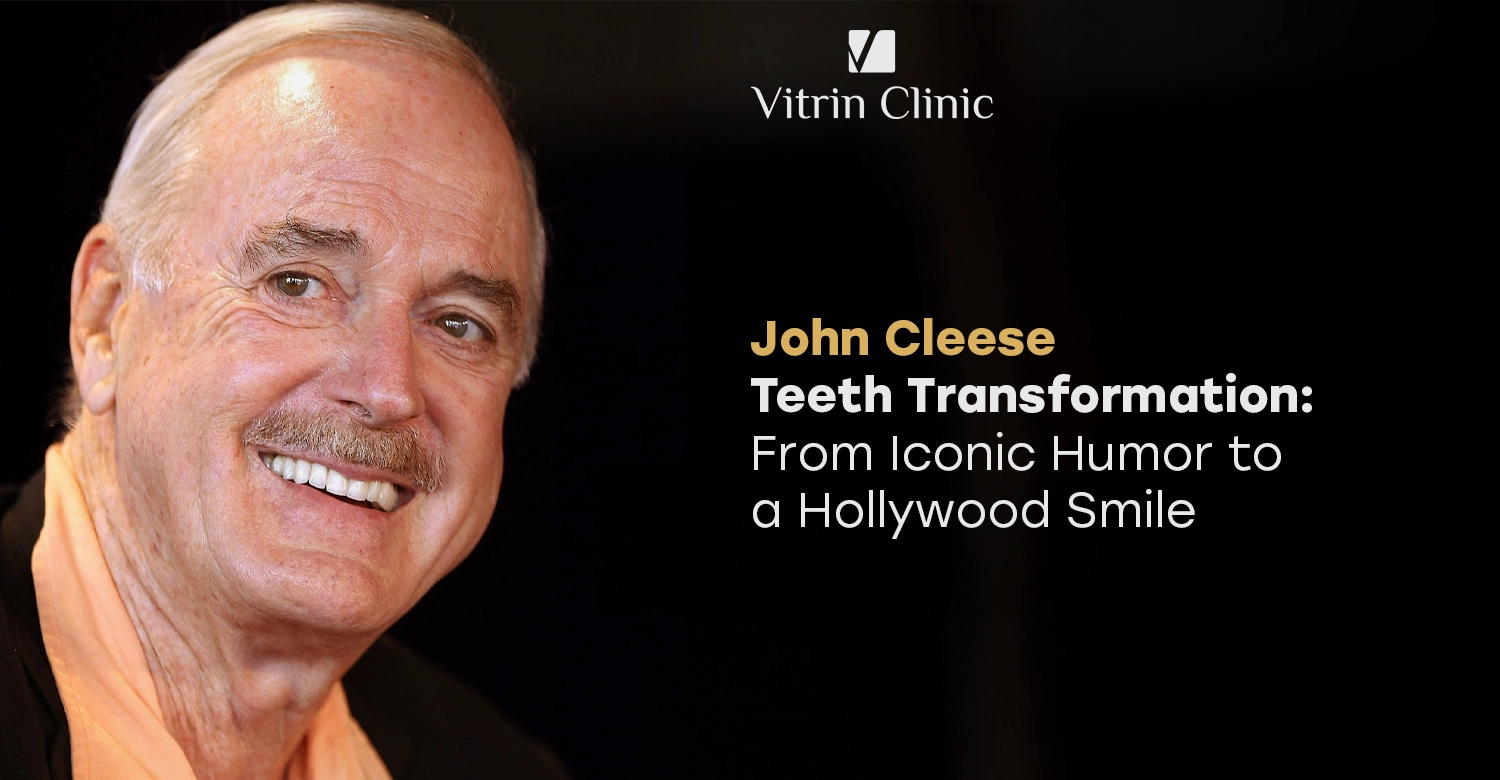John Cleese teeth
