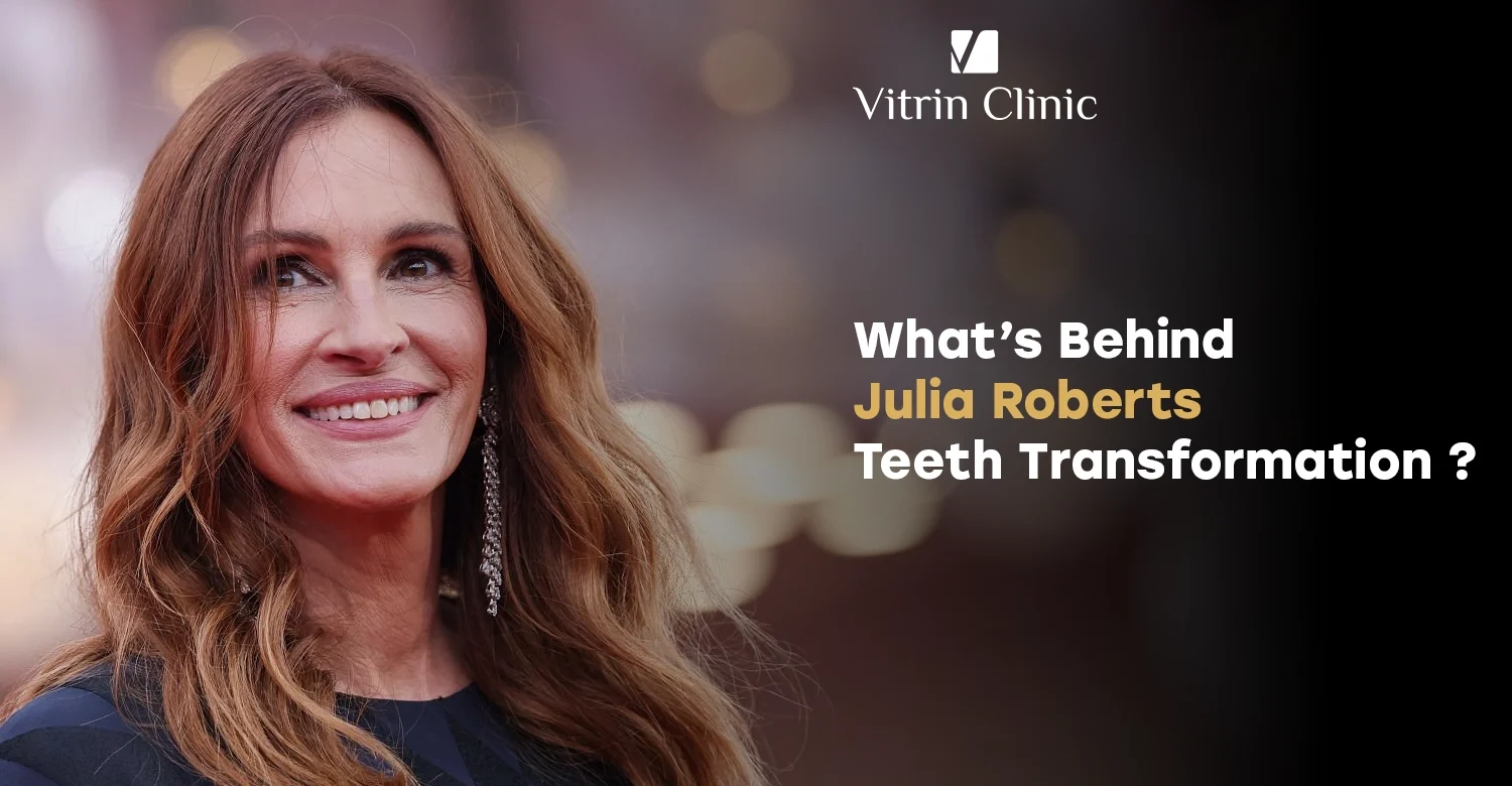 Julia Roberts Teeth