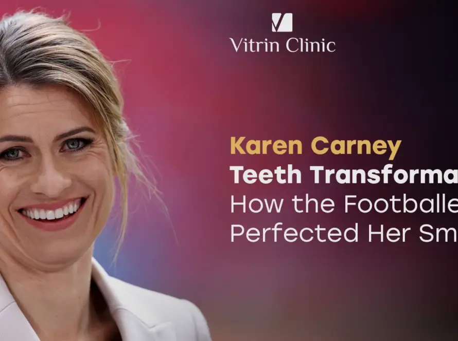 Karen Carney Teeth Transformation