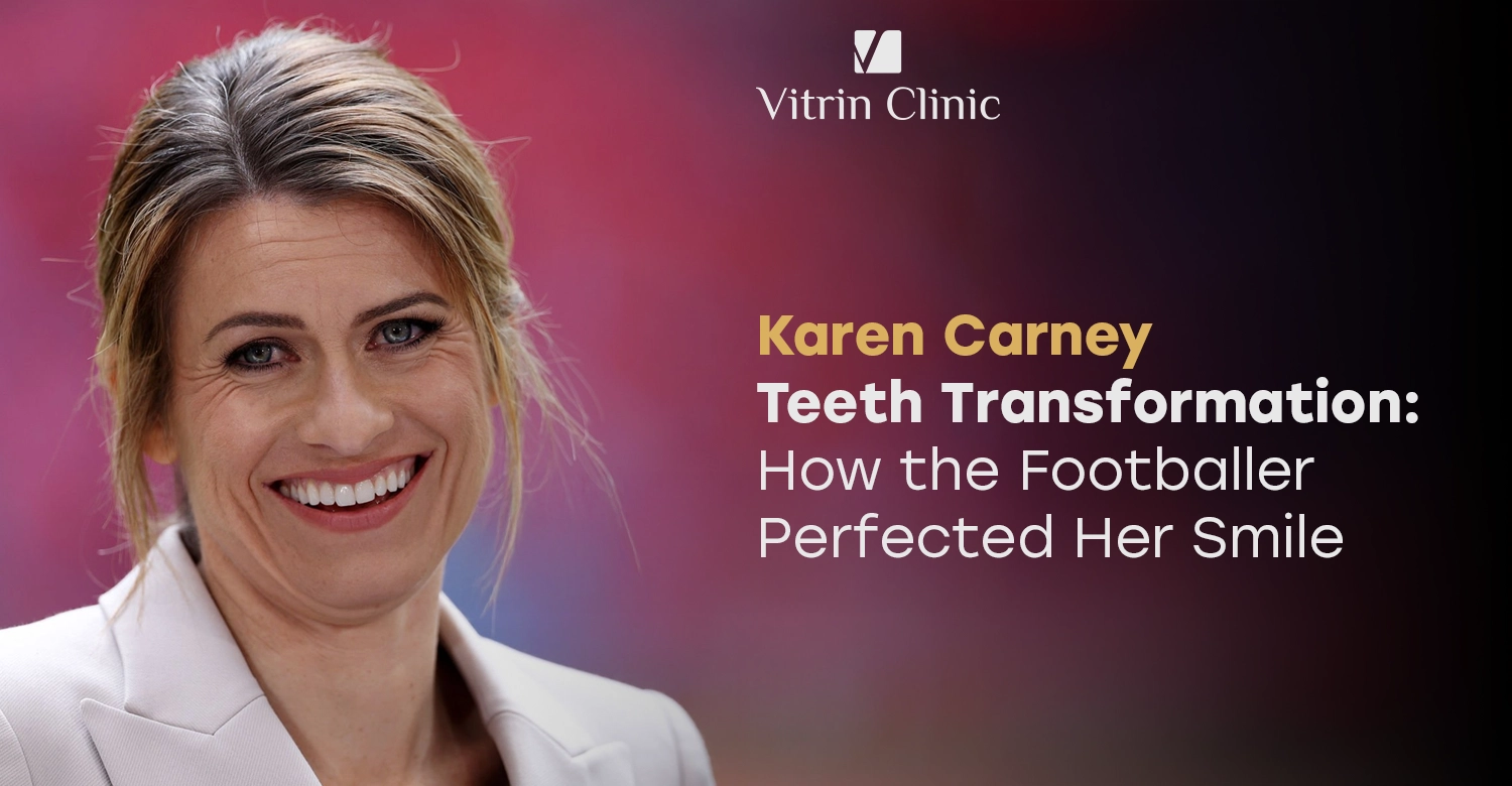 Karen Carney Teeth Transformation