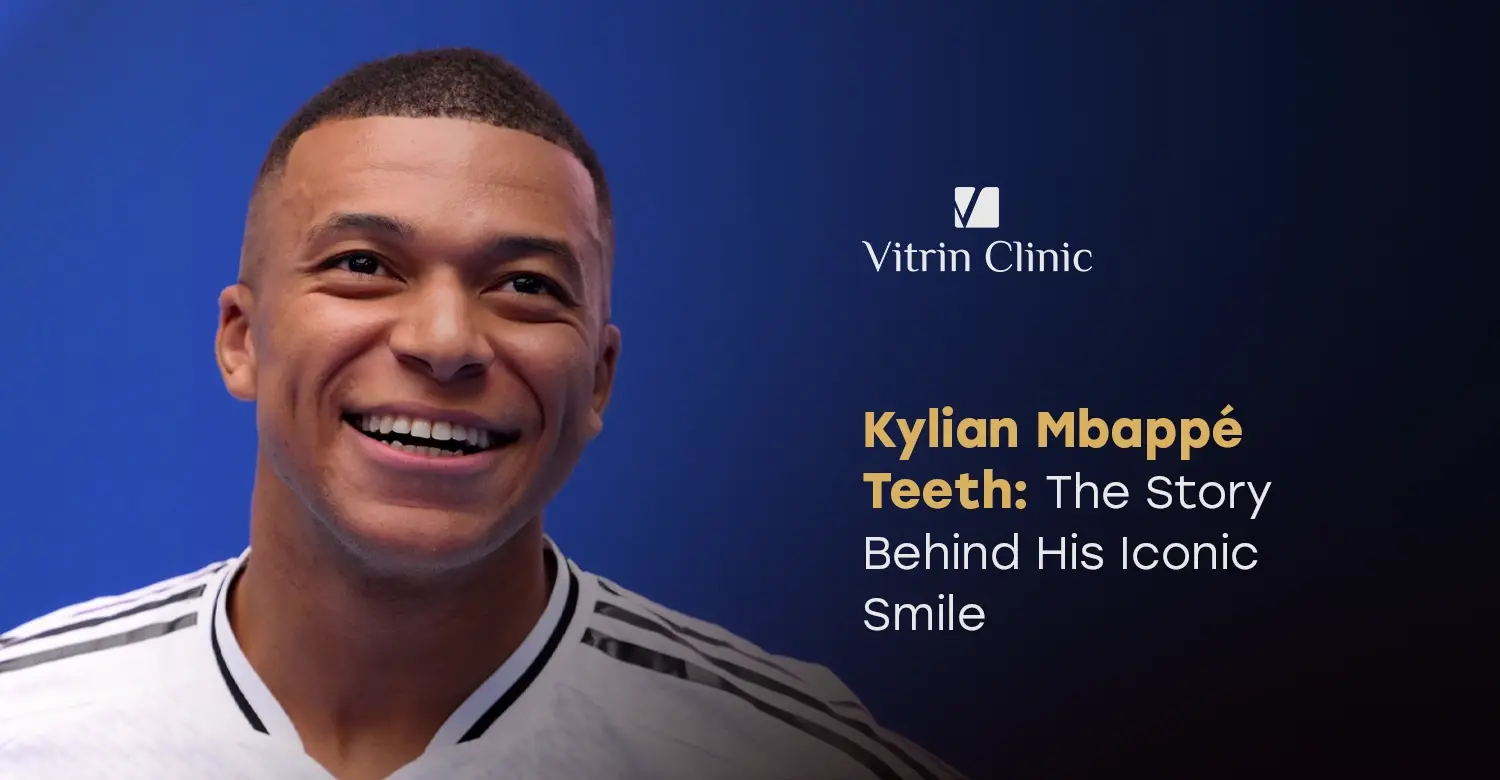 Kylian Mbappé Teeth