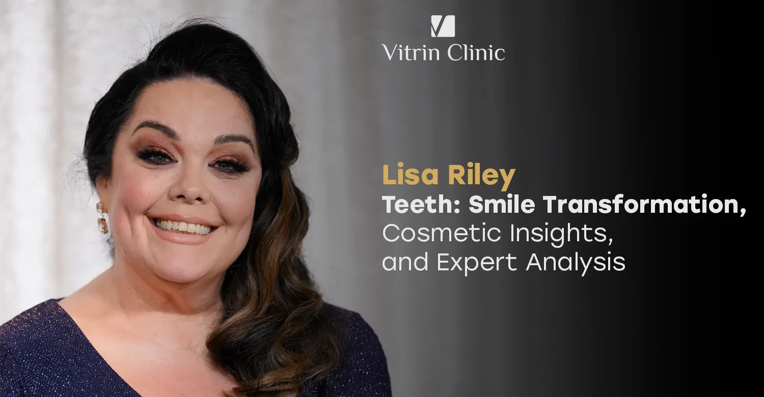 Lisa Riley Teeth