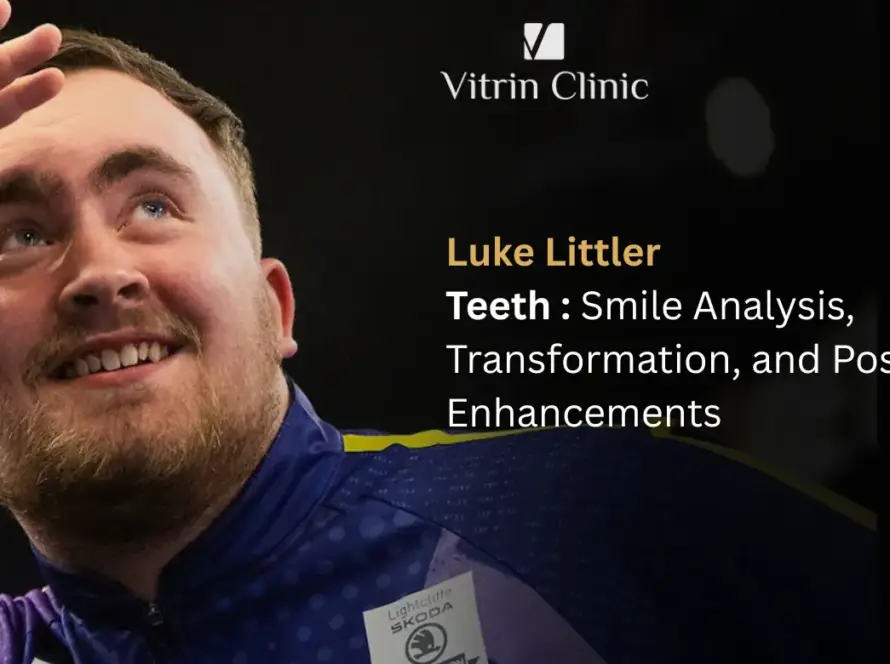 Luke Littler Teeth