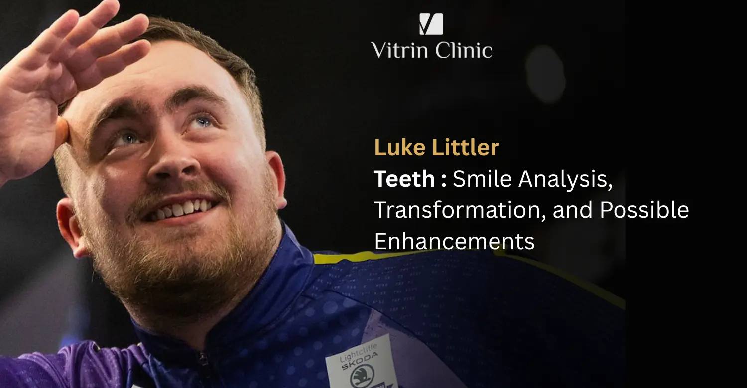 Luke Littler Teeth