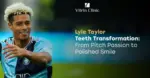 Lyle Taylor Teeth: The Footballer's Complete Smile...