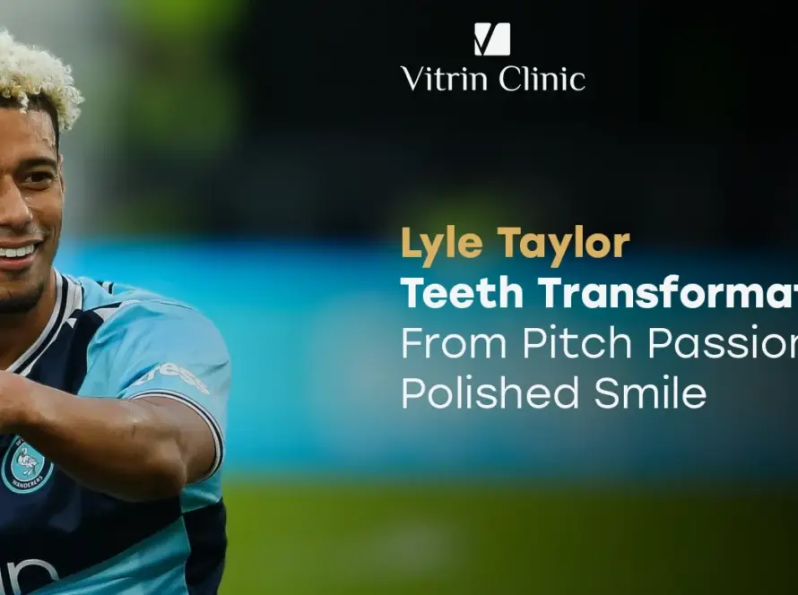 Lyle Taylor Teeth: The Footballer's Complete Smile...