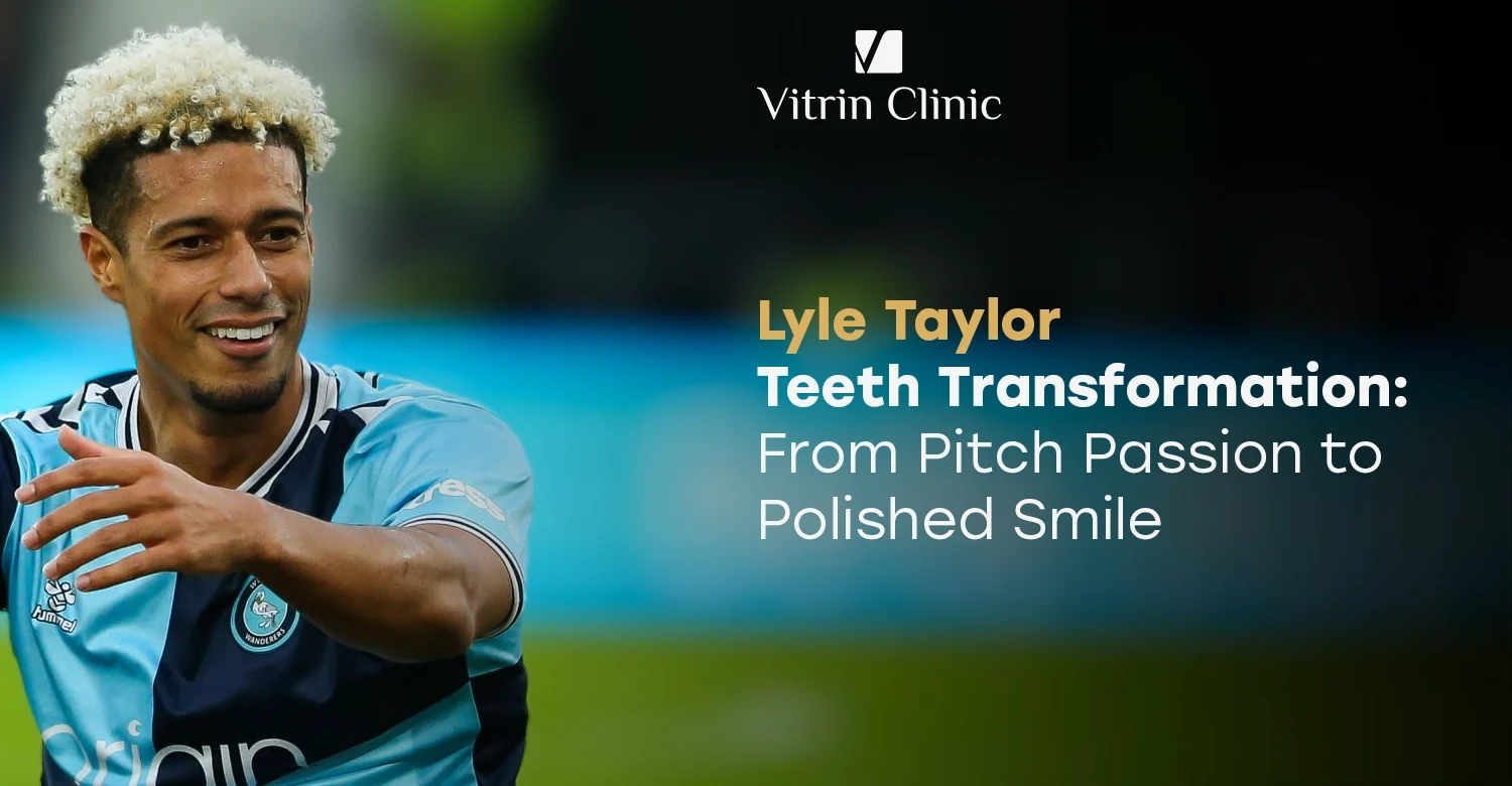 Lyle Taylor Teeth: The Footballer's Complete Smile...