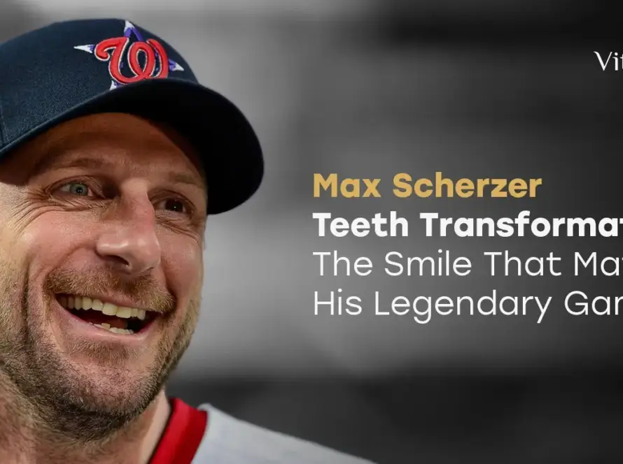 Max Scherzer Teeth Transformation: The Smile That Matches His Legendary Game