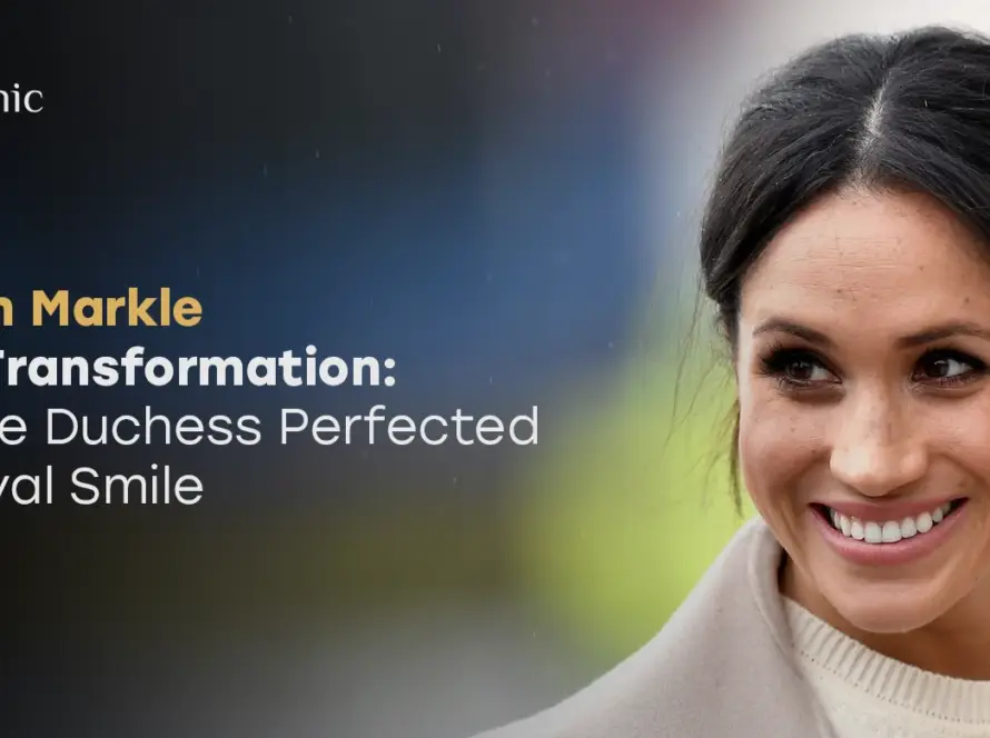 Meghan Markle teeth