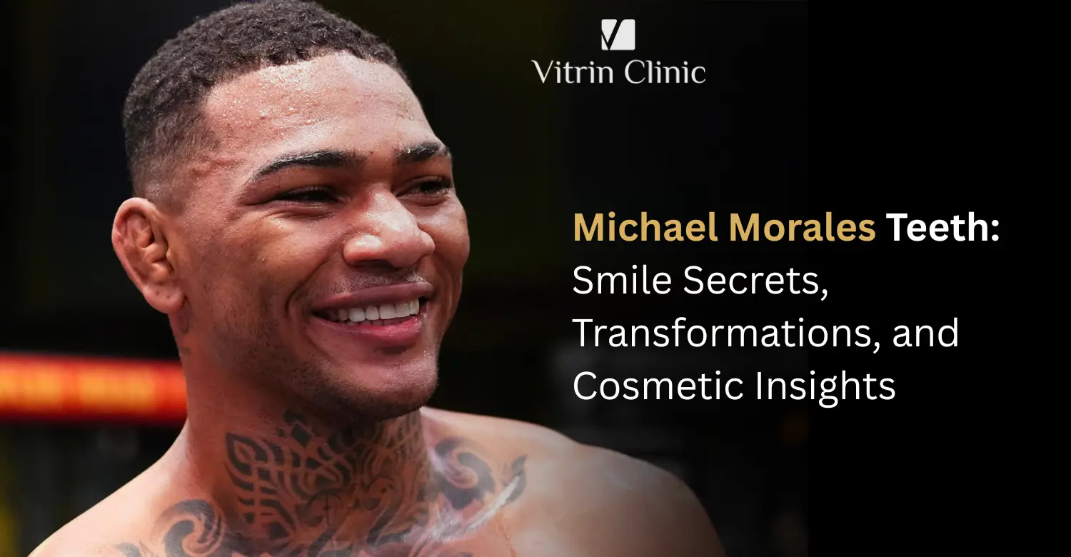 Michael Morales Teeth