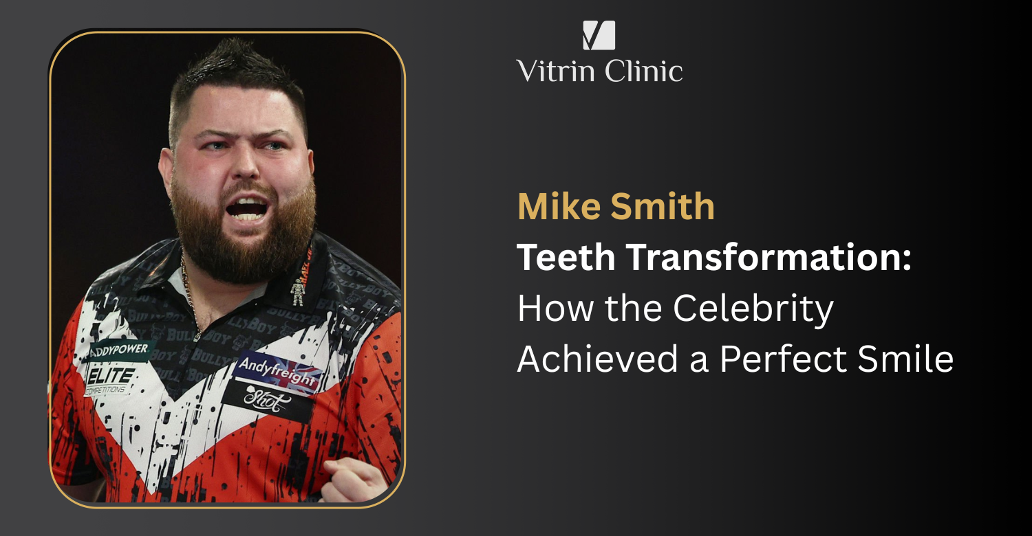 Mike Smith Teeth Transformation: How the Celebrity Achieved a Perfect Smile