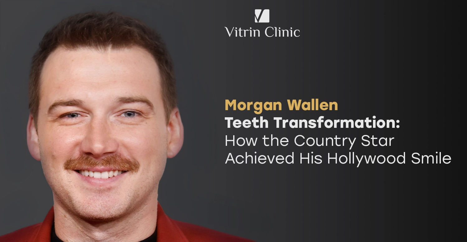 Morgan Wallen teeth
