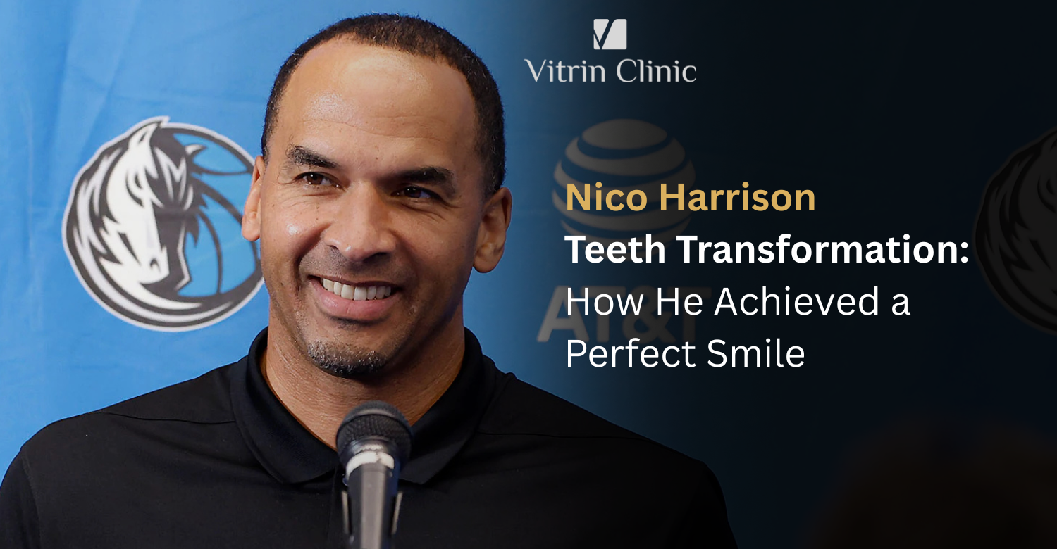 Nico Harrison Teeth: The Mavericks Executive's Smile Evolution